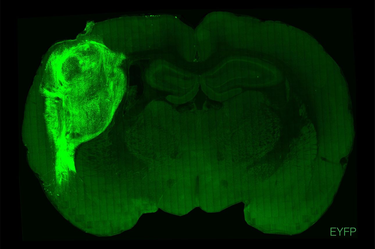 Otizm ve şizofreniyi anlamak için fare beyninde insan hücresi büyüttüler