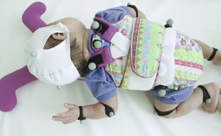 İleri derece prematüre bebekler için 'kaykay'lı çözüm: Motor becerilerini artırıyor