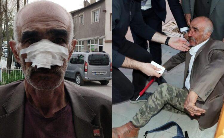 Erzurum’daki saldırıda burnu kırılan Talip Bingöl: Polisler hiçbir şey yapmadı