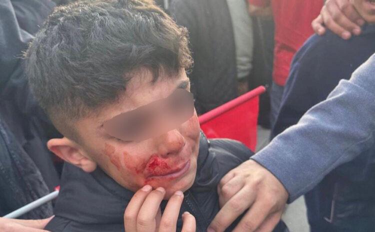 Erzurum saldırısında 15 kişi gözaltına alındı, sonra bırakıldı