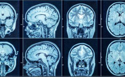 Türkiye’de bilim ve kadın sporcular için mükemmel bir haftaydı