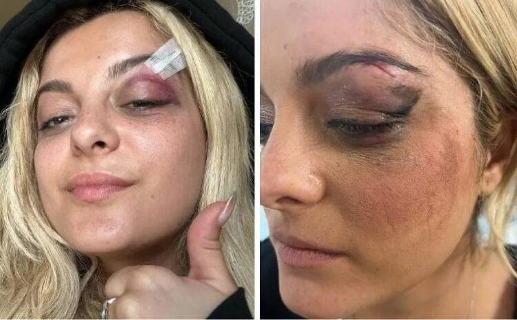 Bebe Rexha'ya saldırı: Domates bitti, telefon yeni moda