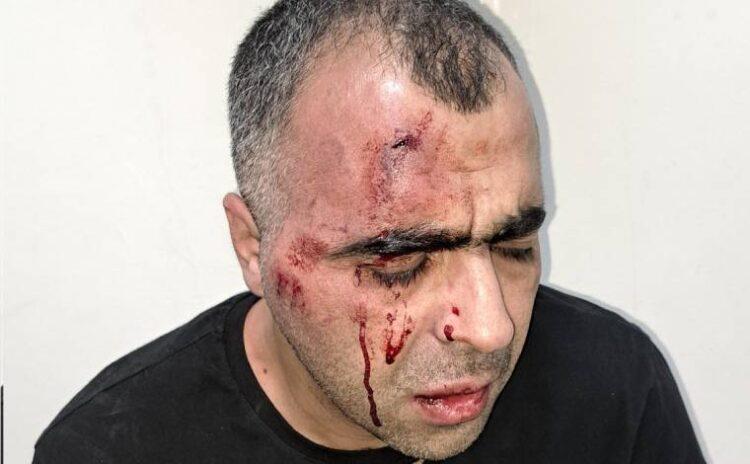 Polis erketeye yattı, koruma gazeteciyi dövdü: Başkan hakkında nasıl yazarsın