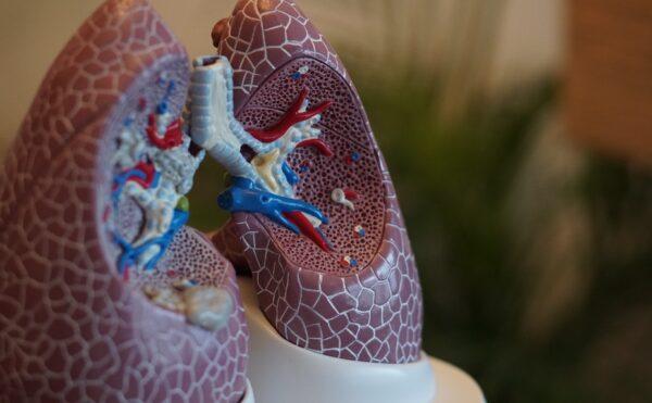 Güzel haber: BioNTech, akciğer kanseri ilacında da ilerleme kaydetti