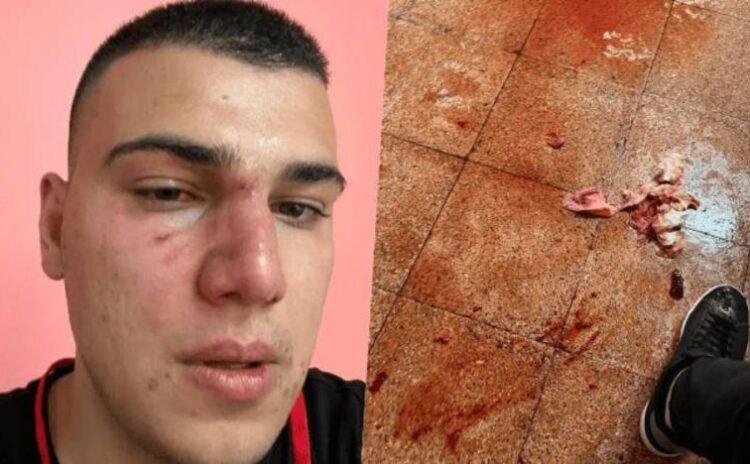 CHP'nin mahalle kongresinde kavga: Birisinin beli kaydı, diğerinin burnu kırıldı
