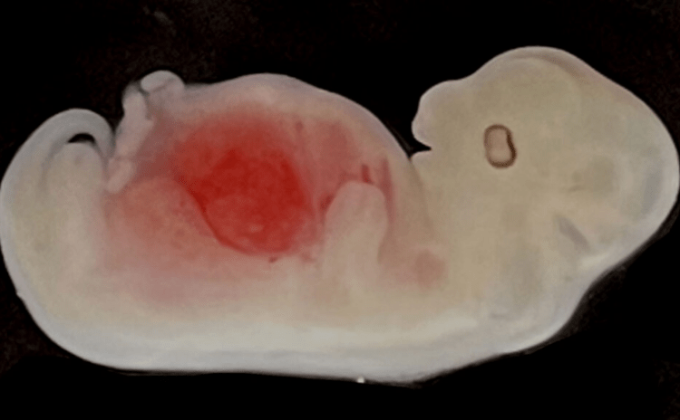 10'ca bilim arasından: İlk kez domuz embriyosunda çoğunluğu insan hücresinden oluşan böbrek üretildi
