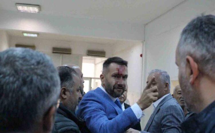 Belediye Meclisi karıştı: MHP’li üye CHP’li üyenin burnunu kırdı