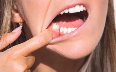 Dünyanın diş çıkartan ilk ilacı klinik deneylere hazırlanıyor