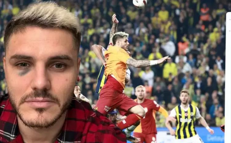 Galatasaray'da Icardi bir süre yok!