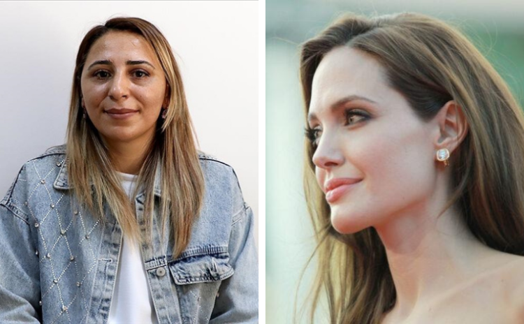 'Angelina Jolie yöntemi'yle önlem: Meme kanseri riskini cesur bir kararla düşürdü