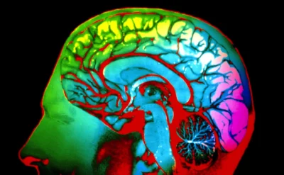 Benim kırmızı gördüğümü siz de kırmızı olarak görüyor musunuz?