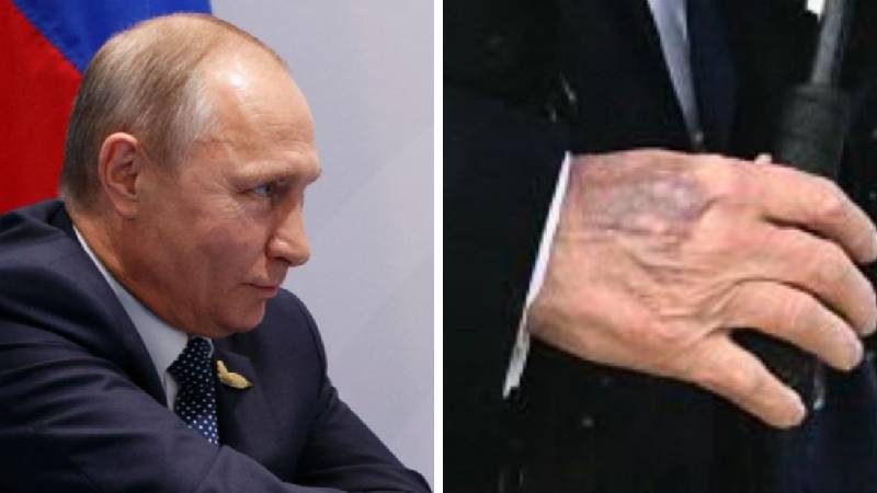 Putin’in sağ elinin görüntüsü neyin habercisi?