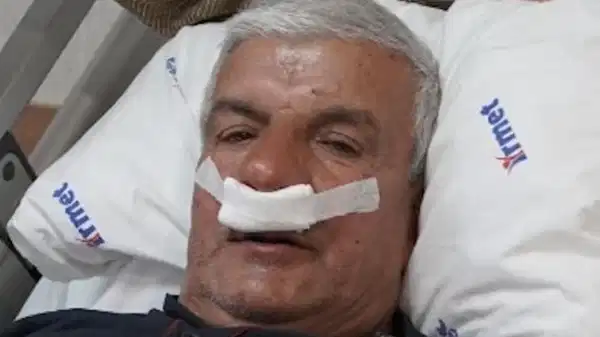 Burnundan 100 gramlık beton taş çıkarıldı