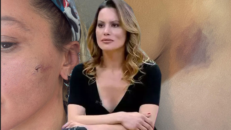 Ünlü oyuncu Yıldız Asyalı’dan iddia: Kocam tarafından darp edildim!