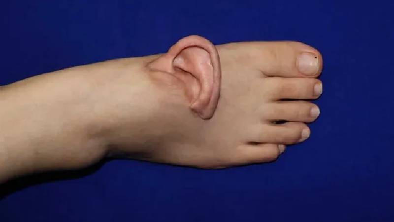 Kopan kulak önce ayağa dikilip canlı tutuldu, sonra yerine dikildi