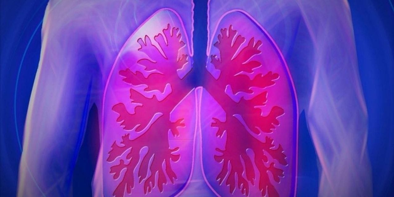 48 saat akciğersiz yaşadı, hayatta kaldı