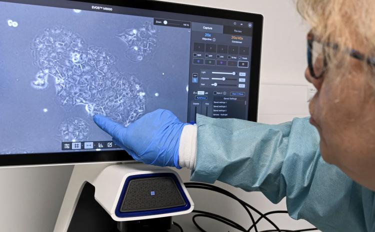 Pankreas kanserine karşı ilk kez çok büyük bir ümit