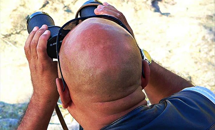 Dünyada en çok kel erkek nerede var? Türkiye en üstte değil!