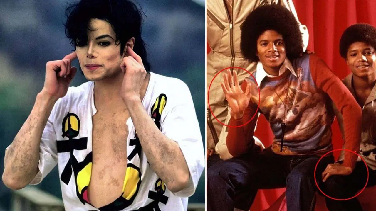 Michael Jackson’ın yeğeni anlattı: ‘Amcamın niyeti beyazlaşmak değildi’